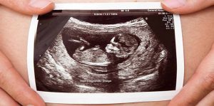 سونوگرافی-هفته-30-بارداری